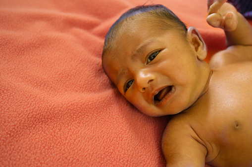 a yellow skin colored neonatal jaundice baby crying in pain.