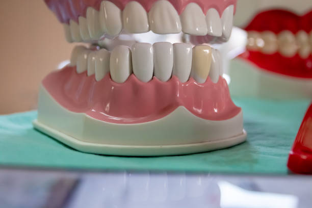 istock Dentures in dental clinics Dentists use it to communicate with patients. 1215423879