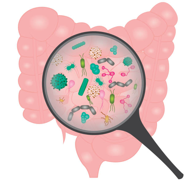 Bacterial overgrowth in small intestine. Bacterial overgrowth in small intestine. Bacteria under a magnifying glass vector illustration irritable bowel syndrome stock illustrations