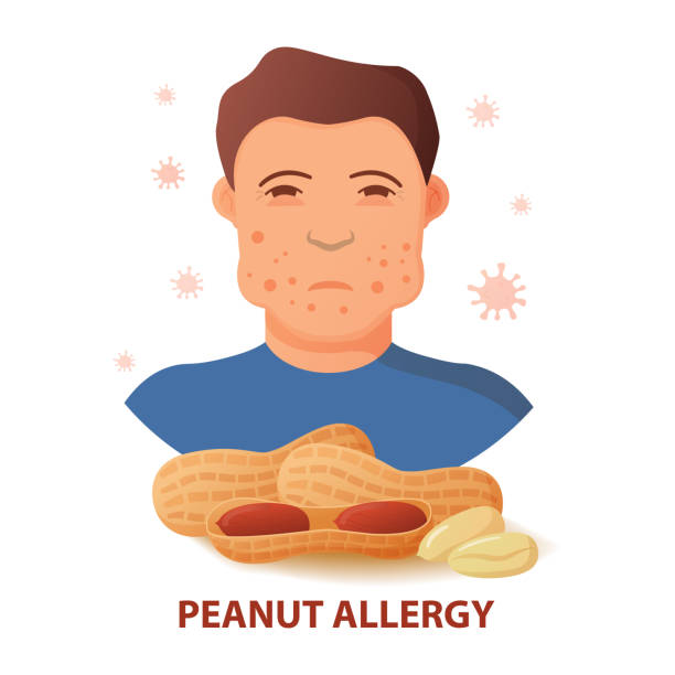 57 Cartoon Of Anaphylaxis Illustrations & Clip Art - iStock 57 Cartoon Of Anaphylaxis Illustrations & Clip Art - iStock