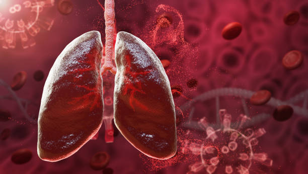 istock Red lung respiratory human sars outbreak,microbe, sars virus pandemic in lung, 3d rendering 1215504015