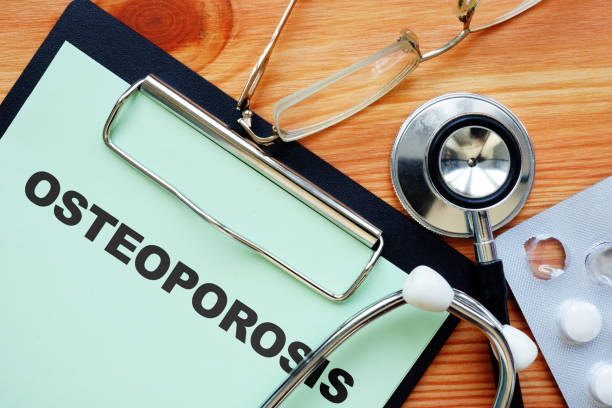 istock Conceptual photo showing printed text Osteoporosis 1215583703
