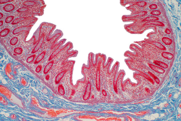 istock Colon biopsy from the colonoscopy. The pathology report describes normal colonic mucosa fragment with colic glands. 1215601081