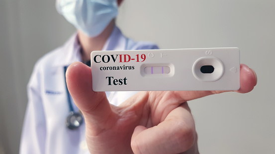 El médico muestra la prueba rápida de laboratorio COVID-19 para el diagnóstico de la nueva infección por el virus Corona (nueva enfermedad del virus corona 2019 o COVID) de Wuhan, lista para su detección y tratamiento. Concepto infeccioso pandémico photo