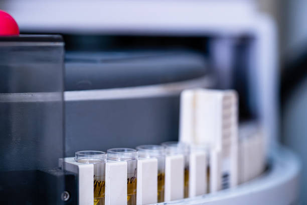 istock Examining urine in laboratory, closeup. 1215685592