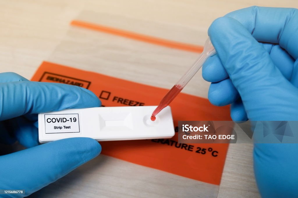 Rapid covid-19 strip Test Coronavirus Stock Photo