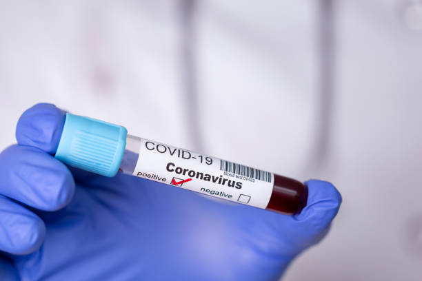 istock Doctor holding blood sample for covid-19 testing 1215720893