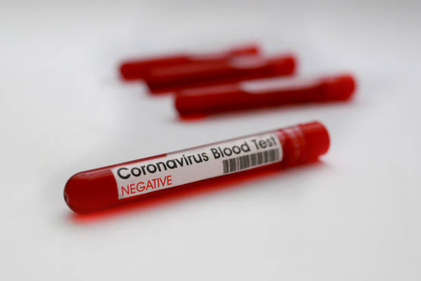 istock Blood sample with respiratory coronavirus negative 1215749982