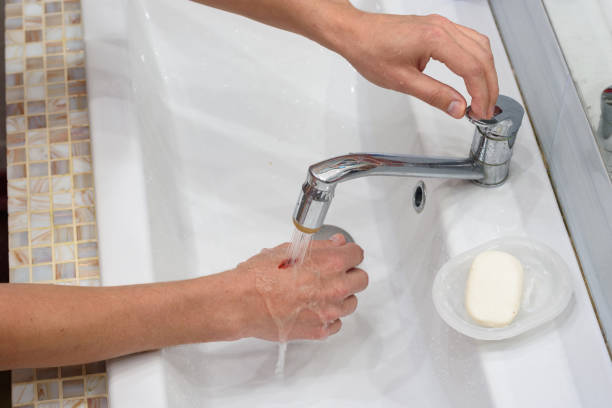 ein mann wäscht eine wunde an der hand unter einem wasserstrom im waschbecken - wunde stock-fotos und bilder