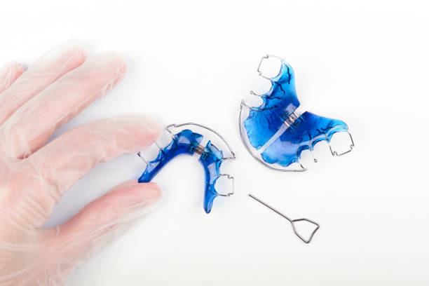 An orthodontist's hand with disposable gloves holds an orthodontic appliance for children stock photo