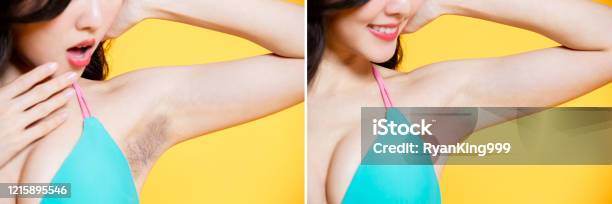 Armpit Hair Removal Concept Stock Photo - Download Image Now - Armpit, Hair  Removal, Asian and Indian Ethnicities - iStock