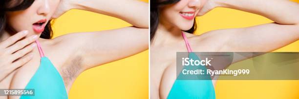 Armpit Hair Removal Concept Stock Photo - Download Image Now - Armpit, Hair Removal, Asian and Indian Ethnicities - iStock Armpit Hair Removal Concept Stock Photo - Download Image Now - Armpit, Hair Removal, Asian and Indian Ethnicities - iStock
