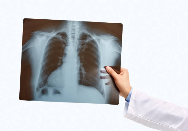 arzt hand hält eine lunge radiographie - x ray x ray image human hand anatomy stock-fotos und bilder