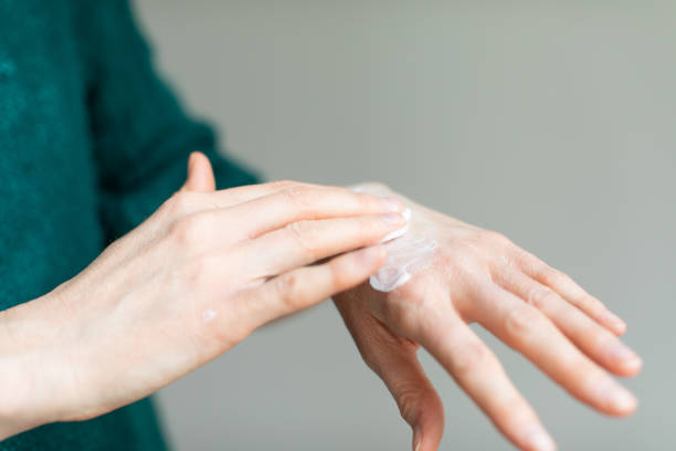 手指消毒剤による乾燥肌を和らげるためにハンドクリームを塗布する女性 - ネイルケア 写真 ストックフォトと画像