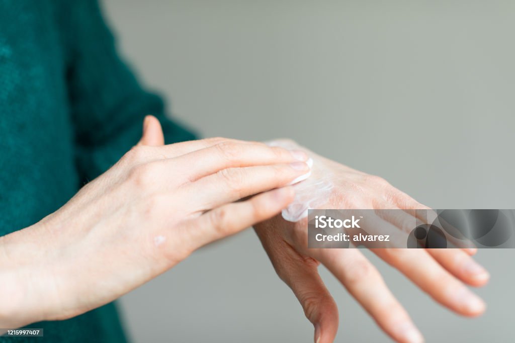 Woman applying hand cream to relieve the dry skin caused by hand sanitizer Washing hands frequently and hand sanitizer protect against COVID-19 but cause drying up of the skin. In the picture a woman applying skin moisturizer to relieve the pain of dry skin Skin Stock Photo