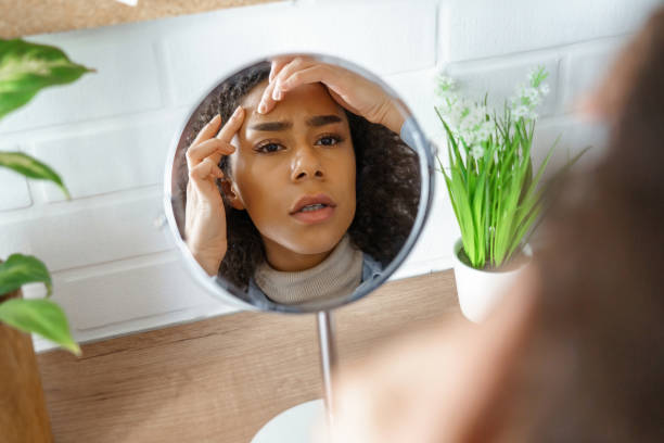 African teen girl feel worried about facial skin problem look in mirror. Young woman touch face squish pop zit pimple on forehead frustrated by blackheads. Black skin care problem, self care concept. chica adolescente africana se siente preocupada por el problema de la piel facial se miran en el espejo. mujer joven toque cara squish pop zit grano en la frente frustrado por los puntos negros. problema de cuidado de la piel negra, concepto de cuidado per