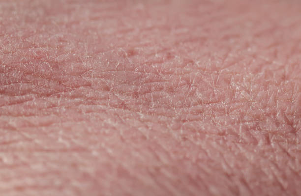 texture di rosa malsano chapped pelle umana coperta da rughe profonde e squame secche e crepe - human skin female wrinkled women foto e immagini stock