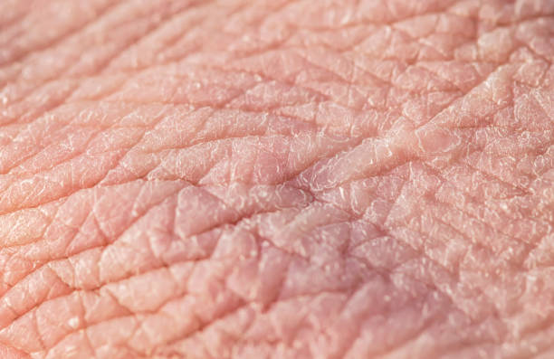 texture screppata rosa della pelle umana con rughe profonde e fiocchi secchi - human skin female wrinkled women foto e immagini stock
