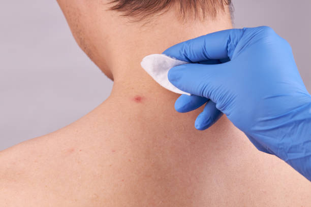 istock caucasian male with skin problems. acne check. skin care concept. 1216267580