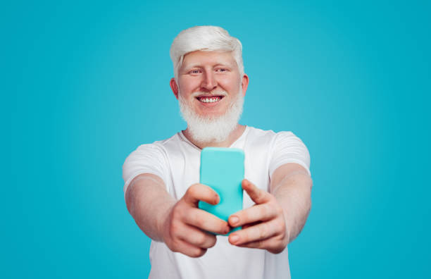 istock Cheerful albino guy taking selfie in studio 1216291348