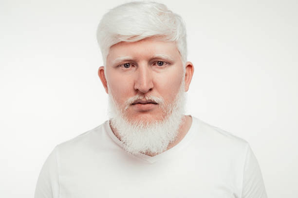 Albino Man Isolated On White Background Stock Photo - Download Image Now -  Men, White Hair, Albino - iStock