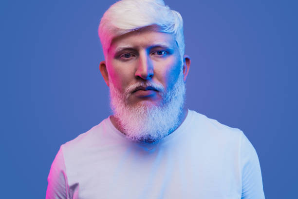 istock Calm guy with albinism on neon background 1216291370