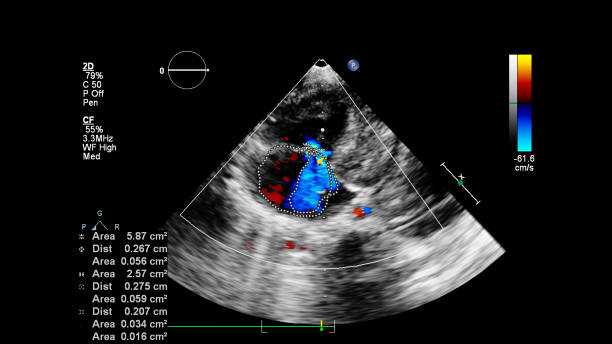 経食道超音波中の心臓の画像。 - pulmonary valve ストックフォトと画像