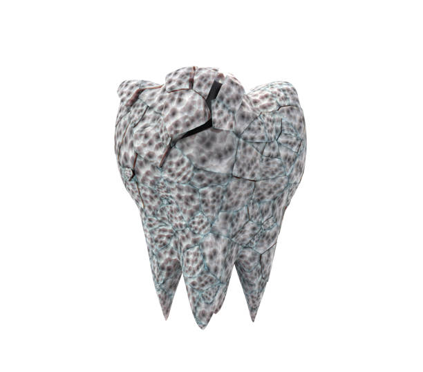 istock dirty broken molar tooth isolated on white background 1216437659