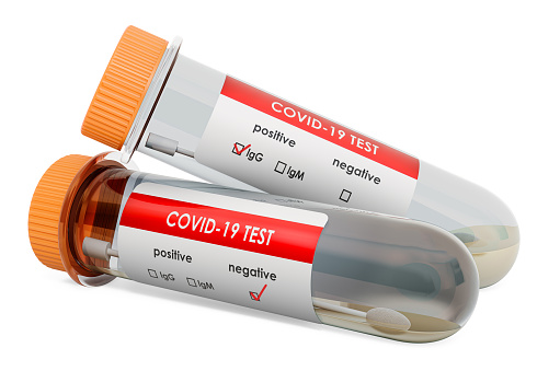 Test tubes with COVID-19 nasal swab laboratory tests, 3D rendering isolated on white background