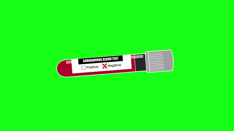 Live News Flash Lower Third on a Green Screen Background Free Stock Video Footage Download Clips chroma key Live News Flash Lower Third on a Green Screen Background Free Stock Video Footage Download Clips chroma key