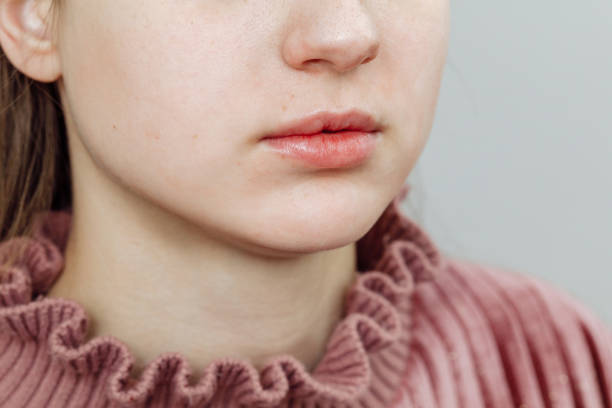istock Lips after permanent makeup in beauty salon 1216507334