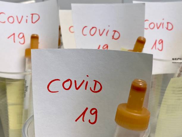 istock Prepared Coronavirus SARS-CoV-2 COVID-19 tests in laboratory 1216517692