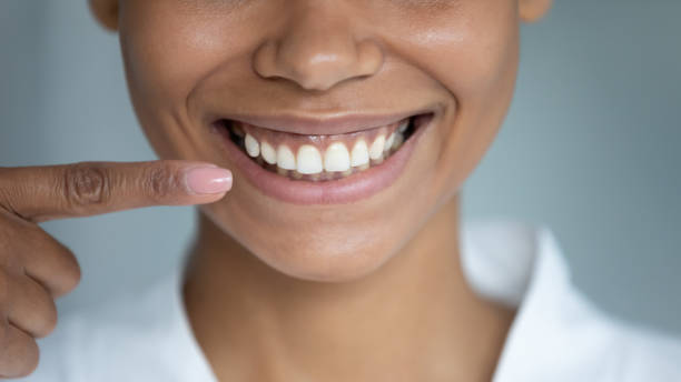 primer plano mujer africana punto dedo en perfecta sonrisa blanca dentón - enamel fotografías e imágenes de stock