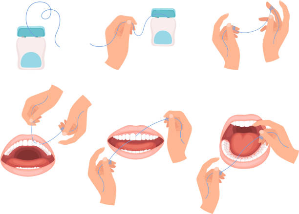 stockillustraties, clipart, cartoons en iconen met floss tandheelkunde. stappen hoe hygiëne floss te gebruiken voor tanden medische tandarts vector infographic schema - orthodontist illustraties