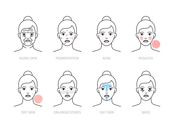 皮膚の問題アイコン:老化、油性、乾燥肌、酒さ、にきび、色素沈着、毛穴の拡大、目の下のバッグ - human skin dry human face peeling点のイラスト素材／クリップアート素材／マンガ素材／アイコン素材