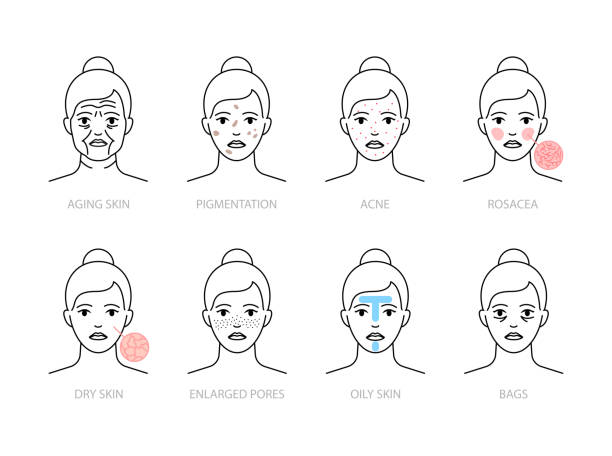 Skin problems icons: aging, oily, dry skin, rosacea, acne, pigmentation, enlarged pores, bags under eyes Skin problems icons: aging, oily, dry skin, rosacea, acne, pigmentation, enlarged pores, bags under eyes facial mask beauty product illustrations stock illustrations