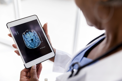 La cirujana femenina sostiene la tableta digital con rayos X cerebrales en la pantalla photo