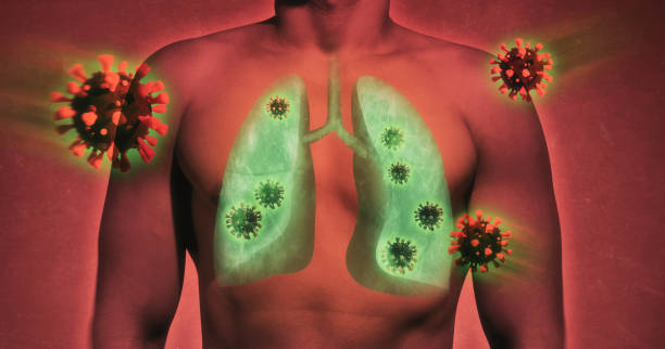istock Lung damage by coronavirus covid-19 1216646909
