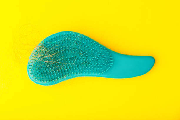 istock girl with a comb and problem hair on the yellow background. 1216652194