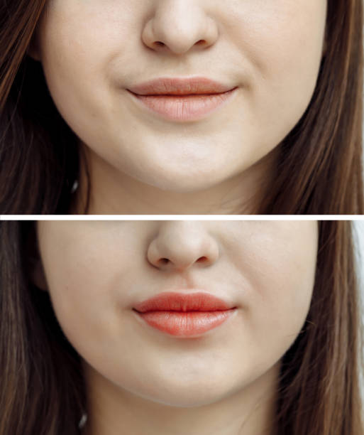Photo comparison before and after permanent makeup, tattooing of lips