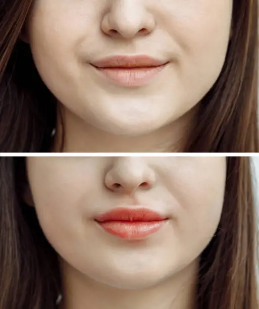 Photo comparison before and after permanent makeup, tattooing of lips for woman in beauty salon
