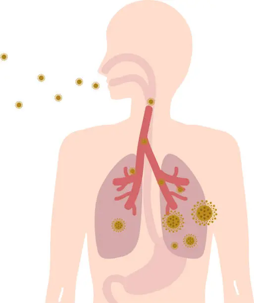 Vector illustration of This is an illustration icon of absorbing and coughing up a virus.
