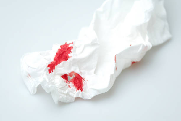 istock blood stains on a white paper 1216743073