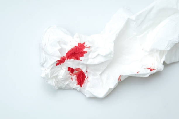 istock blood stains on a white paper 1216743098