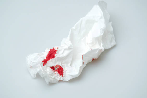 istock blood stains on a white paper 1216743123