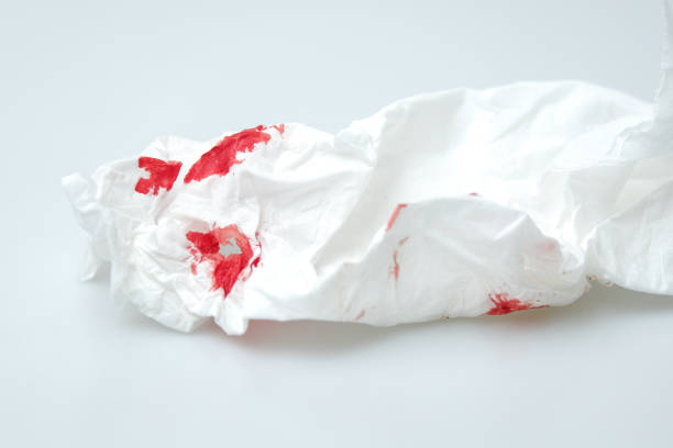 istock blood stains on a white paper 1216744155