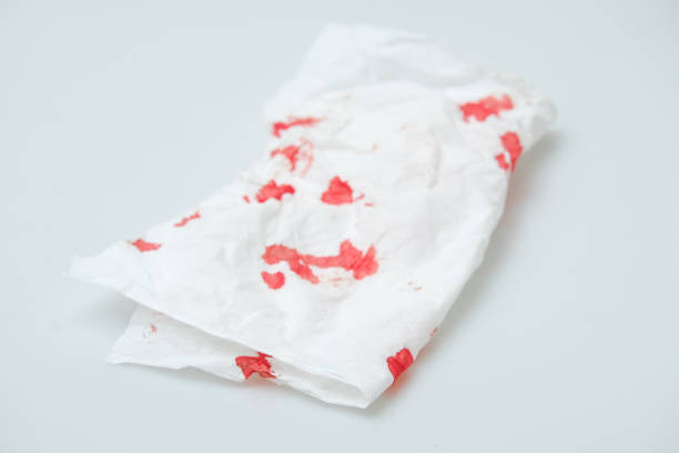 istock blood stains on a white paper 1216744491