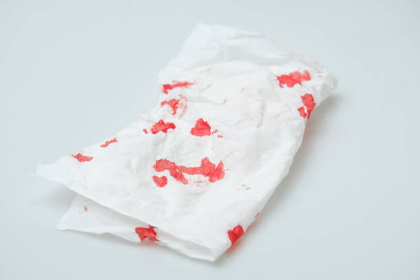 istock blood stains on a white paper 1216744956
