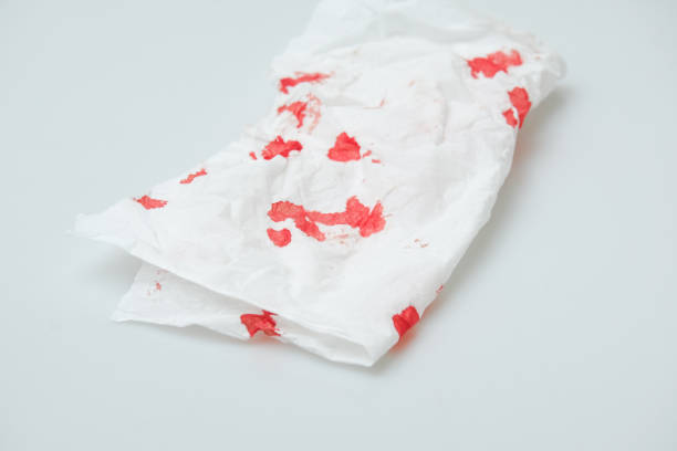 istock blood stains on a white paper 1216745579