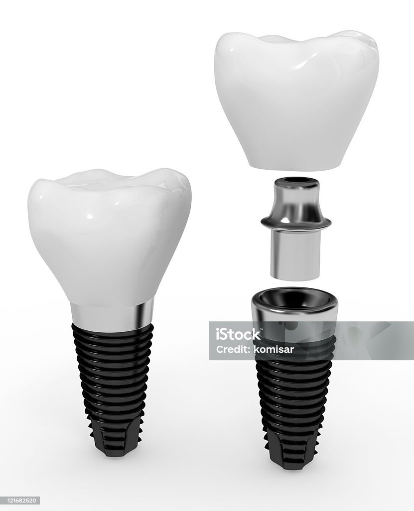 Due impianti dentali su sfondo bianco - Foto stock royalty-free di Apparecchiatura odontoiatrica